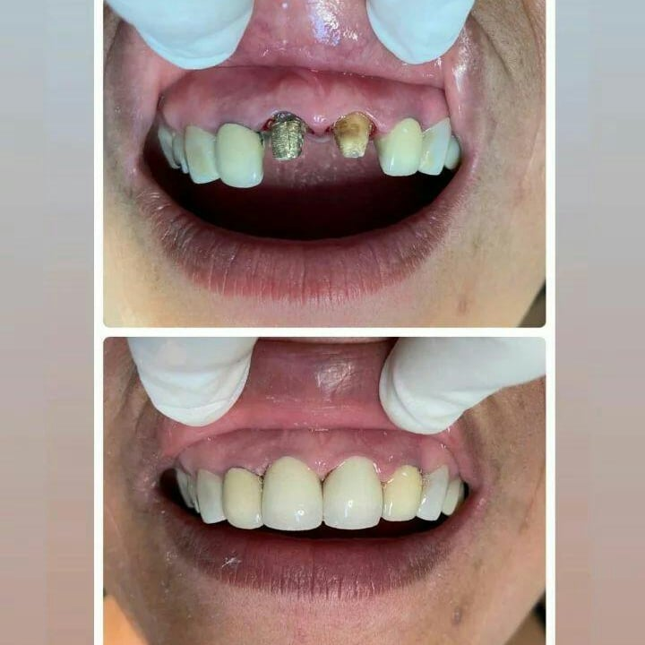 Próteses e Reabilitação Oral